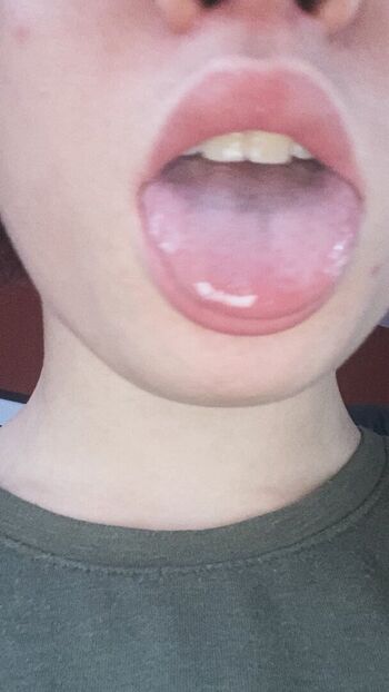 btwkay
